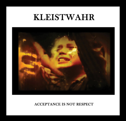 ACCEPTANCE IS NOT RESPECT